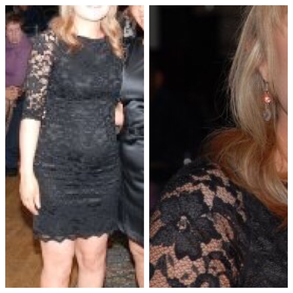 ASOS lace dress / party dress / LBD